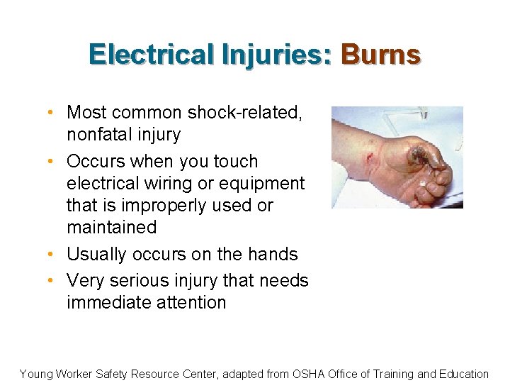 Electrical Injuries: Burns • Most common shock-related, nonfatal injury • Occurs when you touch