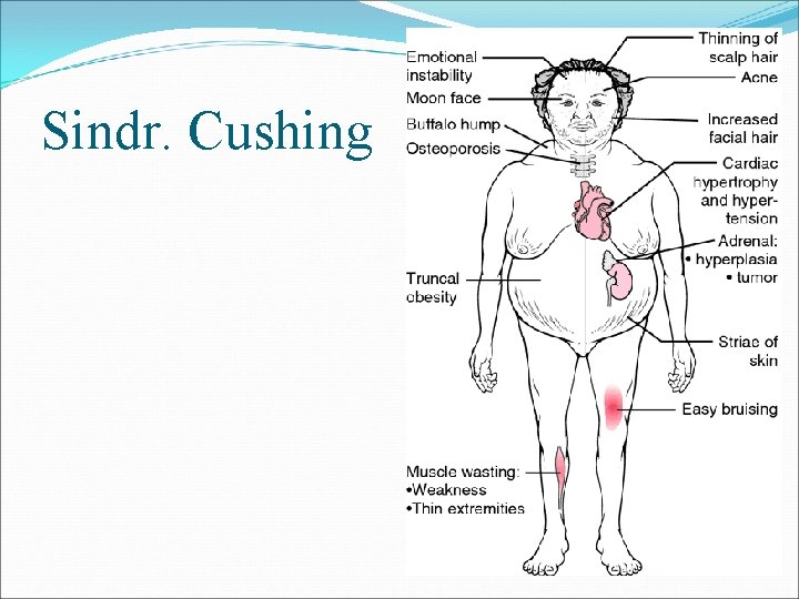 pierderea în greutate boală cushing
