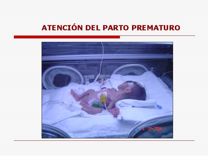 ATENCIÓN DEL PARTO PREMATURO 