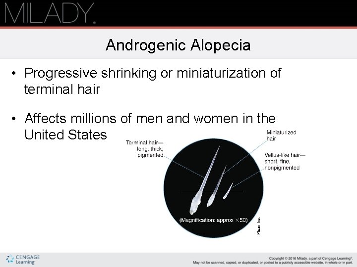 Androgenic Alopecia • Progressive shrinking or miniaturization of terminal hair Pfizer Inc. • Affects