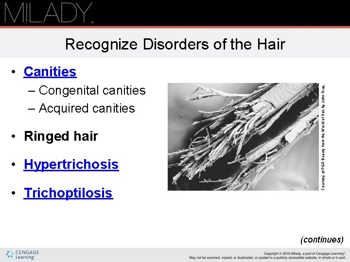 Recognize Disorders of the Hair – Congenital canities – Acquired canities • Ringed hair