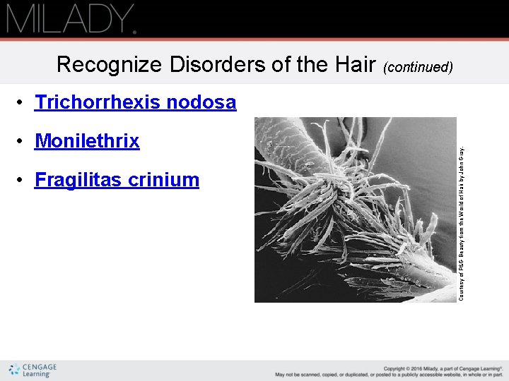 Recognize Disorders of the Hair (continued) • Monilethrix • Fragilitas crinium Courtesy of P&G