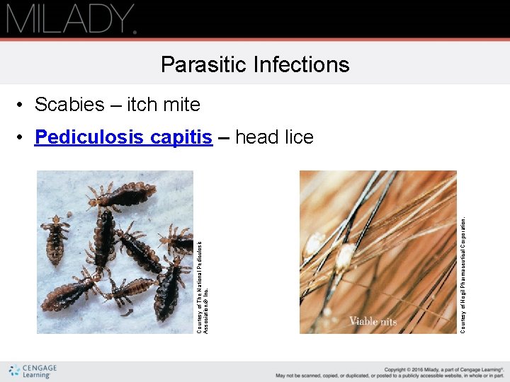 Courtesy of Hogil Pharmaceutical Corporation. Courtesy of The National Pediculosis Association, ® Inc. Parasitic