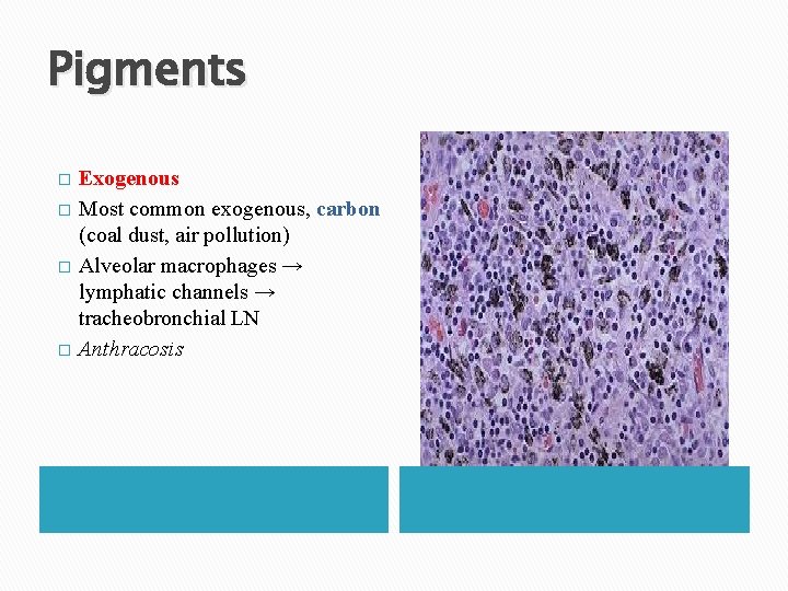 Pigments � � Exogenous Most common exogenous, carbon (coal dust, air pollution) Alveolar macrophages