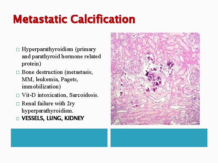Metastatic Calcification � � � Hyperparathyroidism (primary and parathyroid hormone related protein) Bone destruction