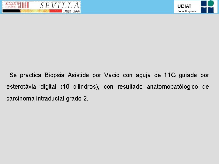 Se practica Biopsia Asistida por Vacio con aguja de 11 G guiada por esterotáxia