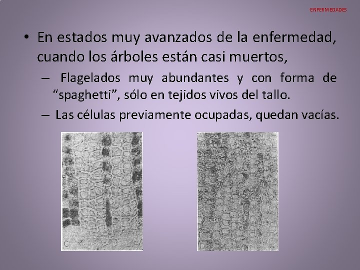 ENFERMEDADES • En estados muy avanzados de la enfermedad, cuando los árboles están casi ENFERMEDADES • En estados muy avanzados de la enfermedad, cuando los árboles están casi
