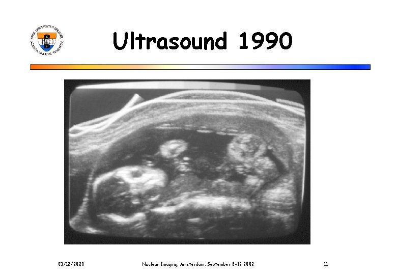 Ultrasound 1990 03/12/2020 Nuclear Imaging, Amsterdam, September 8 -12 2002 11 