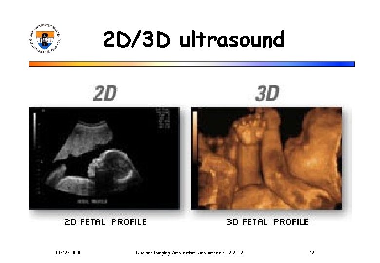 2 D/3 D ultrasound 03/12/2020 Nuclear Imaging, Amsterdam, September 8 -12 2002 12 