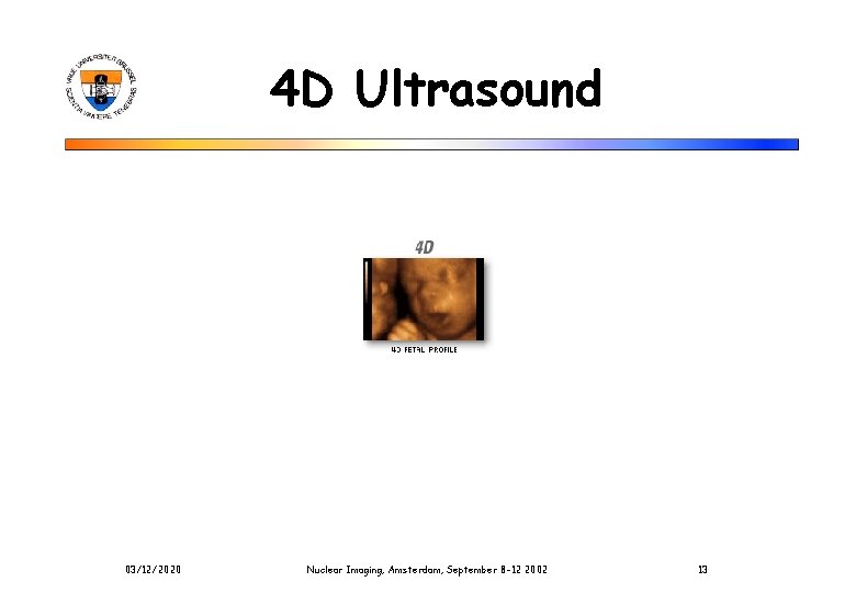 4 D Ultrasound 03/12/2020 Nuclear Imaging, Amsterdam, September 8 -12 2002 13 