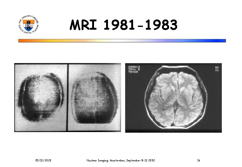 MRI 1981 -1983 03/12/2020 Nuclear Imaging, Amsterdam, September 8 -12 2002 16 
