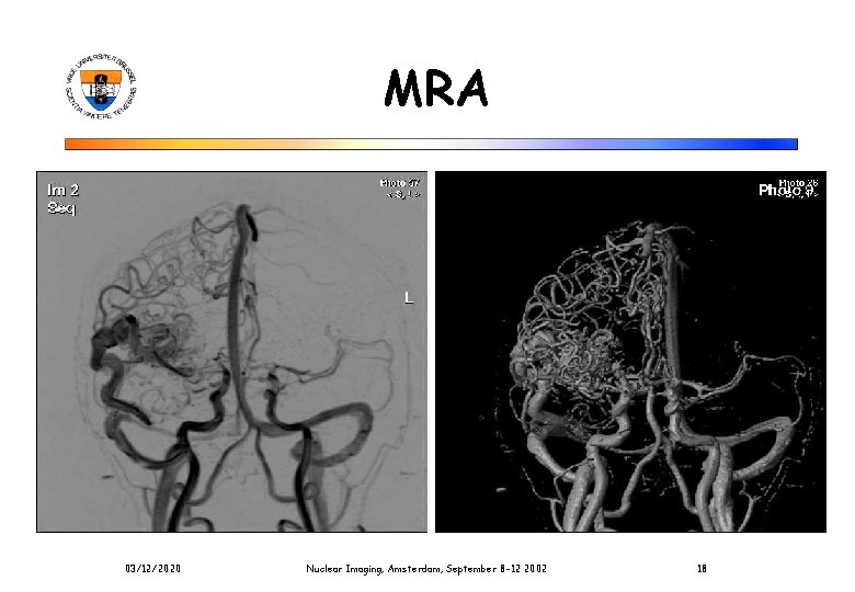 MRA 03/12/2020 Nuclear Imaging, Amsterdam, September 8 -12 2002 18 