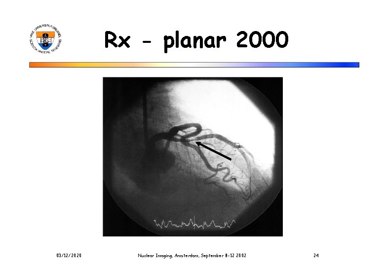 Rx - planar 2000 03/12/2020 Nuclear Imaging, Amsterdam, September 8 -12 2002 24 