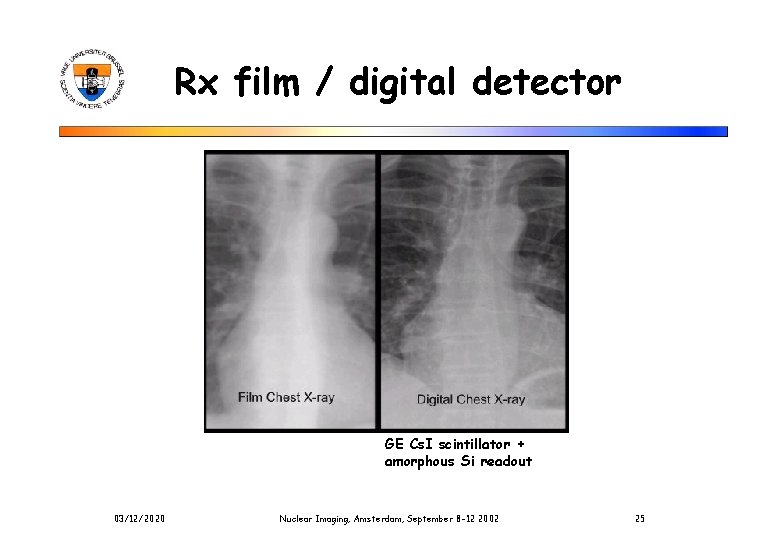 Rx film / digital detector GE Cs. I scintillator + amorphous Si readout 03/12/2020 Rx film / digital detector GE Cs. I scintillator + amorphous Si readout 03/12/2020