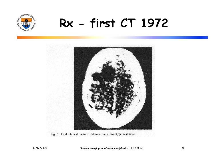 Rx - first CT 1972 03/12/2020 Nuclear Imaging, Amsterdam, September 8 -12 2002 26