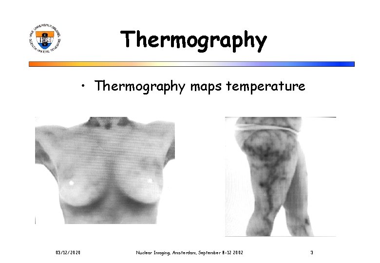 Thermography • Thermography maps temperature 03/12/2020 Nuclear Imaging, Amsterdam, September 8 -12 2002 3