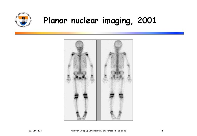 Planar nuclear imaging, 2001 03/12/2020 Nuclear Imaging, Amsterdam, September 8 -12 2002 32 