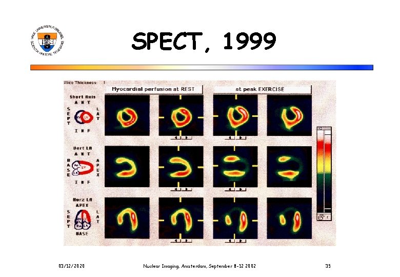 SPECT, 1999 03/12/2020 Nuclear Imaging, Amsterdam, September 8 -12 2002 35 