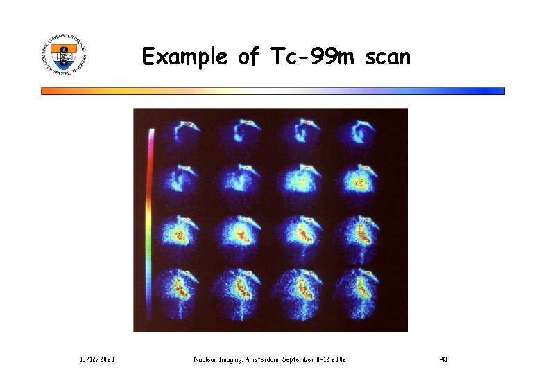 Example of Tc-99 m scan 03/12/2020 Nuclear Imaging, Amsterdam, September 8 -12 2002 43