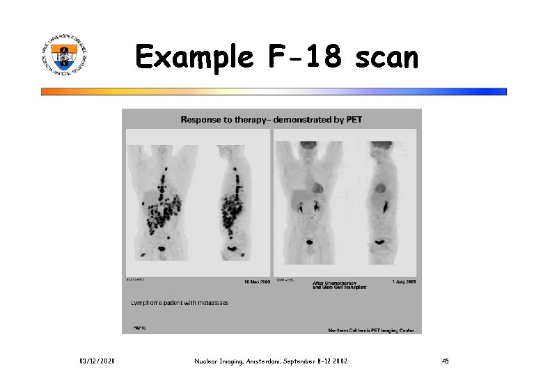 Example F-18 scan 03/12/2020 Nuclear Imaging, Amsterdam, September 8 -12 2002 45 Example F-18 scan 03/12/2020 Nuclear Imaging, Amsterdam, September 8 -12 2002 45