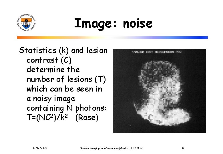 Image: noise Statistics (k) and lesion contrast (C) determine the number of lesions (T)