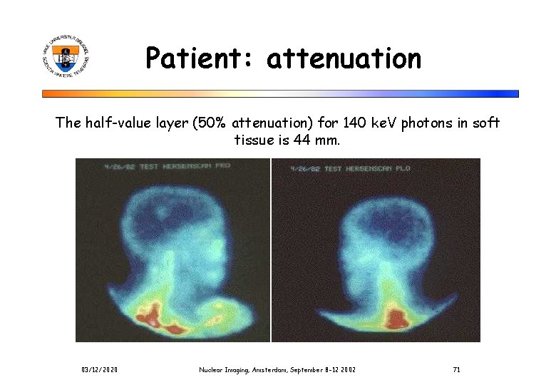 Patient: attenuation The half-value layer (50% attenuation) for 140 ke. V photons in soft