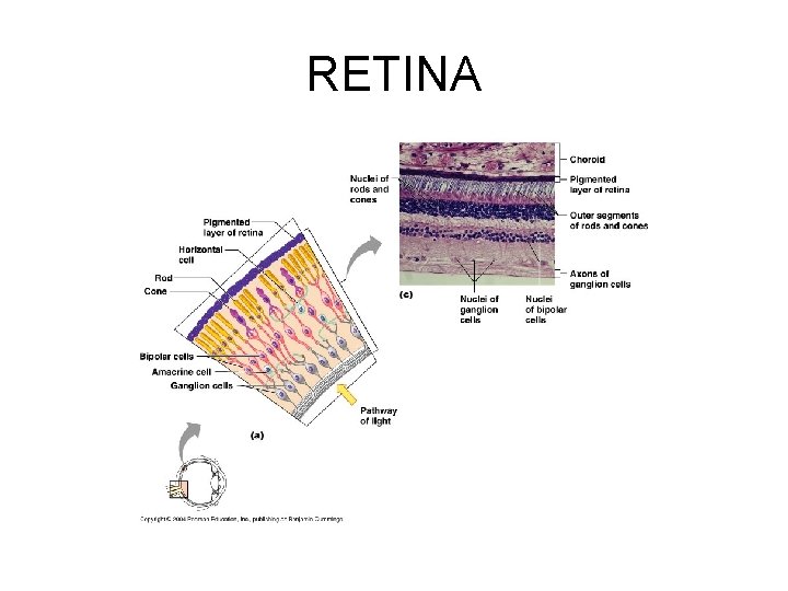 RETINA 