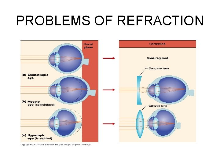 PROBLEMS OF REFRACTION 