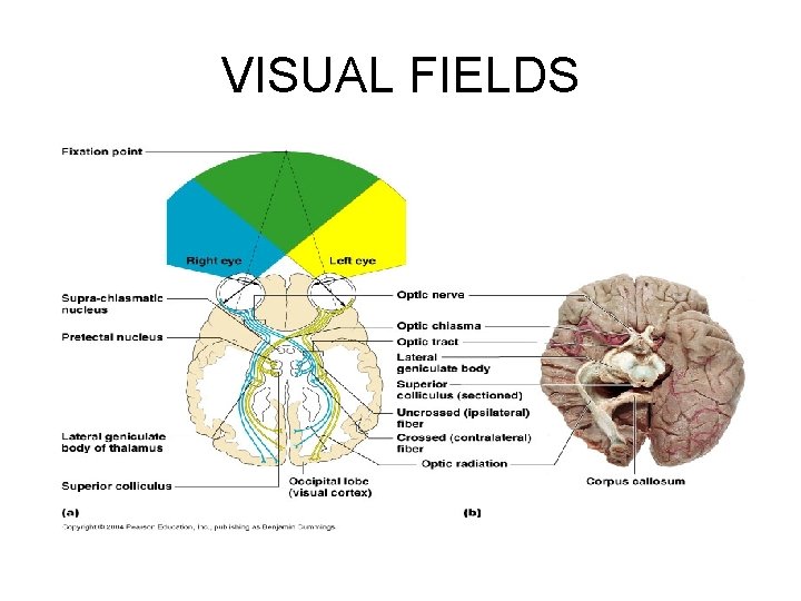 VISUAL FIELDS 