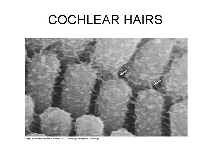 COCHLEAR HAIRS 