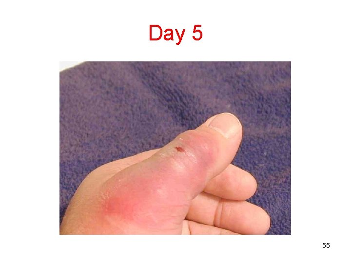 Day 5 55 