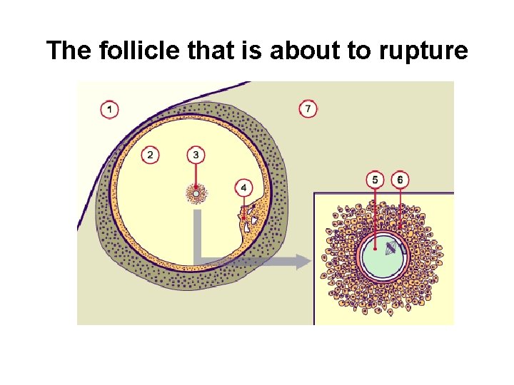 The follicle that is about to rupture 