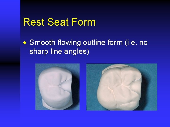 Rest Seat Form · Smooth flowing outline form (i. e. no sharp line angles)
