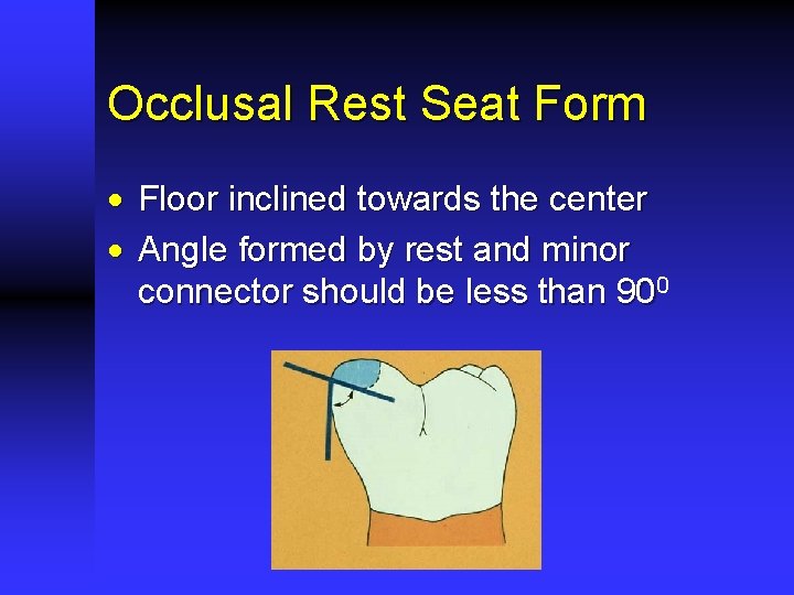 Occlusal Rest Seat Form · Floor inclined towards the center · Angle formed by