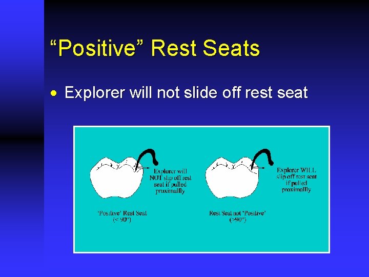 “Positive” Rest Seats · Explorer will not slide off rest seat 