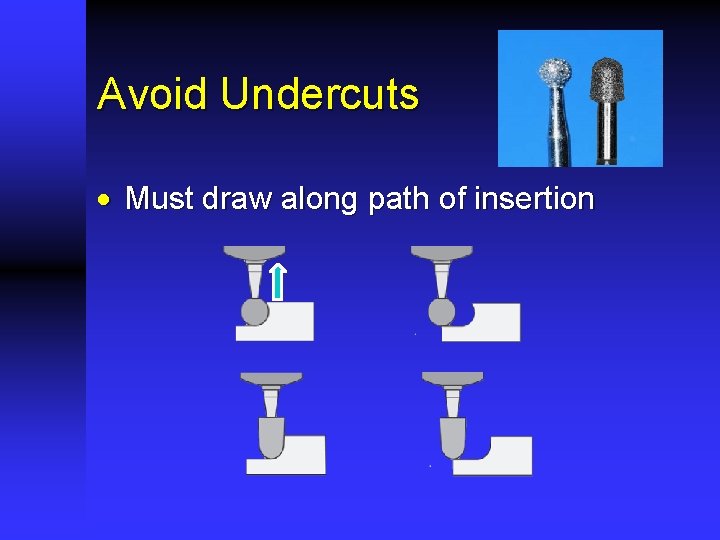 Avoid Undercuts · Must draw along path of insertion 