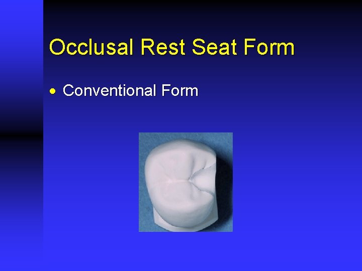 Occlusal Rest Seat Form · Conventional Form 