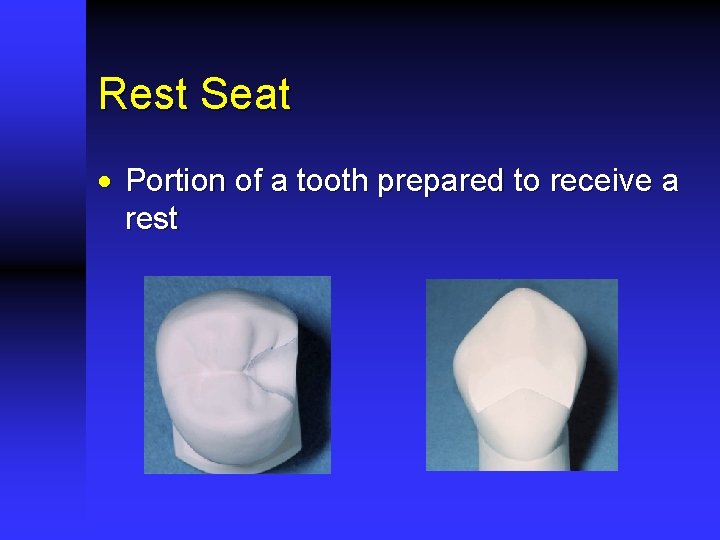 Rest Seat · Portion of a tooth prepared to receive a rest 