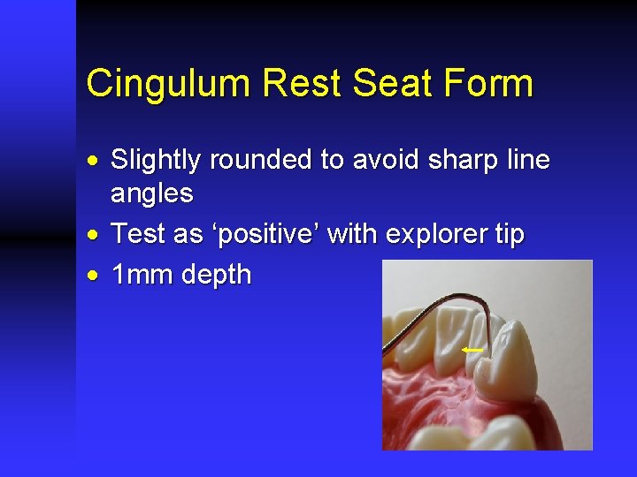 Cingulum Rest Seat Form · Slightly rounded to avoid sharp line angles · Test