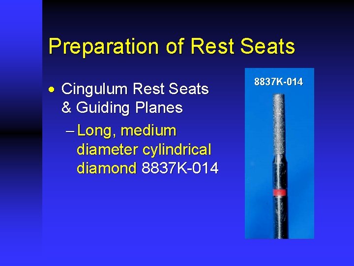 Preparation of Rest Seats · Cingulum Rest Seats & Guiding Planes - Long, medium