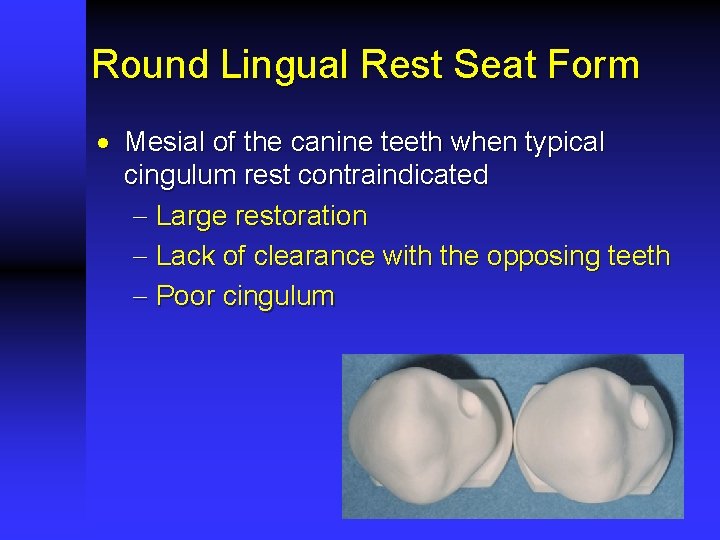 Round Lingual Rest Seat Form · Mesial of the canine teeth when typical cingulum