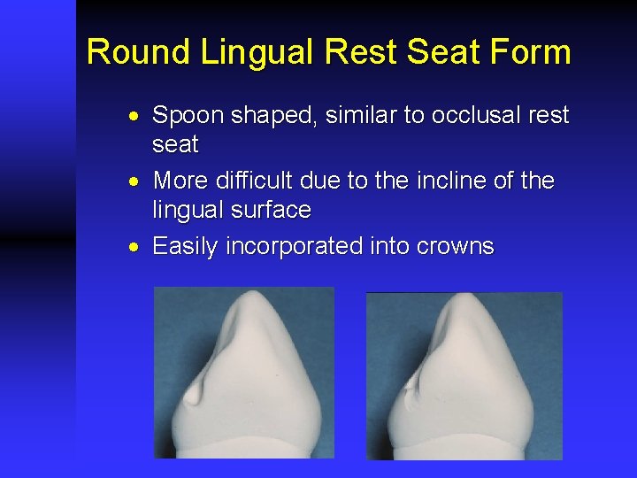 Round Lingual Rest Seat Form · Spoon shaped, similar to occlusal rest seat ·