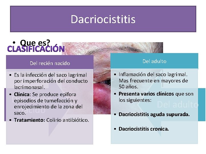 Dacriocistitis • Que es? Del adulto Del recién nacido • La dacriocistitis es la