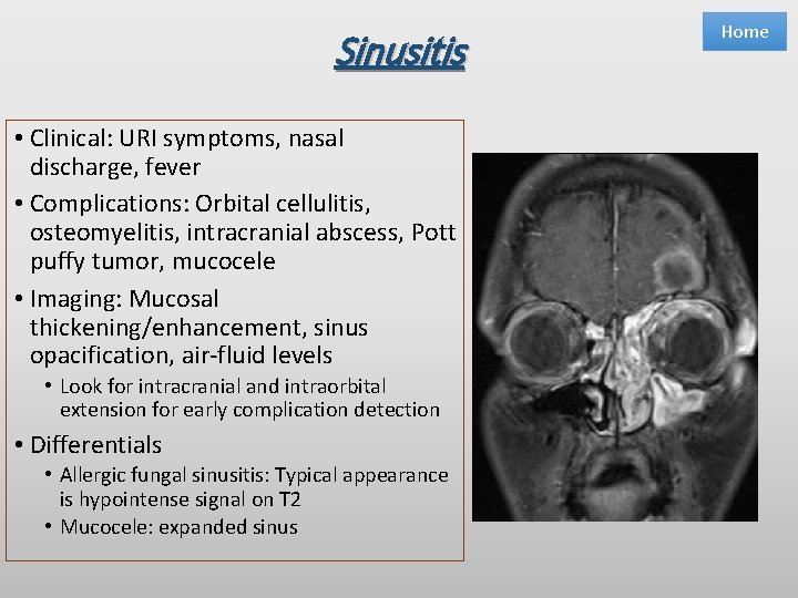 Sinusitis • Clinical: URI symptoms, nasal discharge, fever • Complications: Orbital cellulitis, osteomyelitis, intracranial