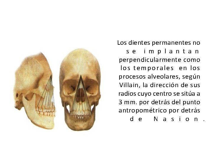 Los dientes permanentes no s e i m p l a n t a