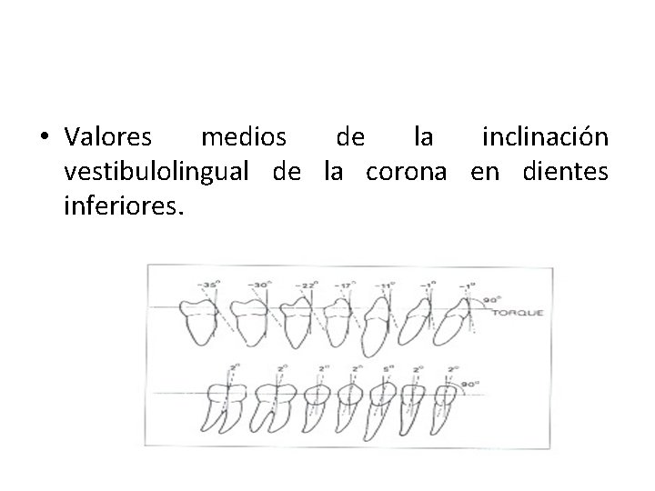  • Valores medios de la inclinación vestibulolingual de la corona en dientes inferiores.