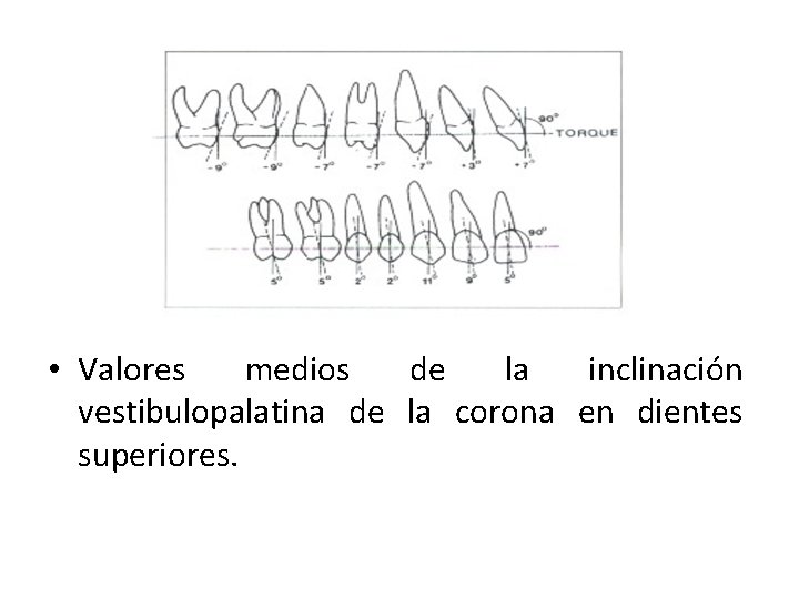  • Valores medios de la inclinación vestibulopalatina de la corona en dientes superiores.