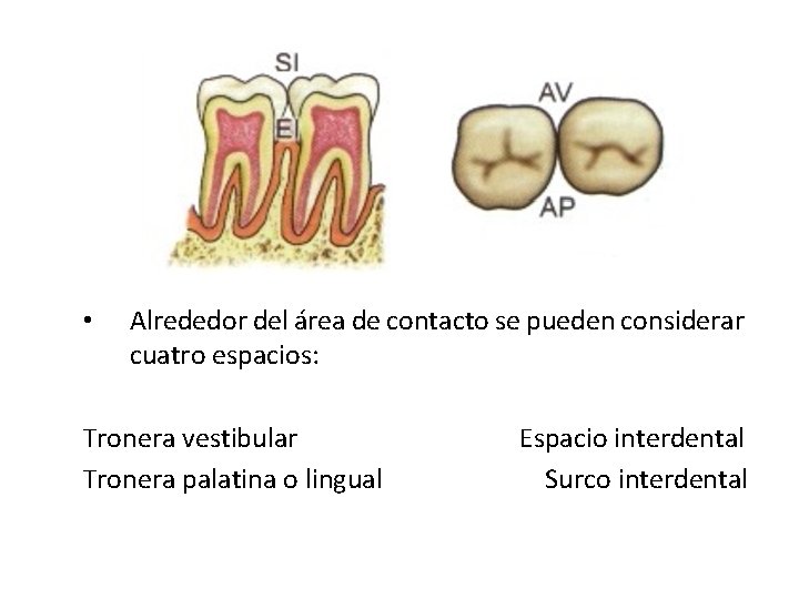  • Alrededor del área de contacto se pueden considerar cuatro espacios: Tronera vestibular