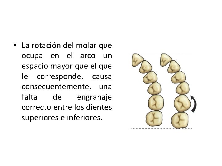  • La rotación del molar que ocupa en el arco un espacio mayor