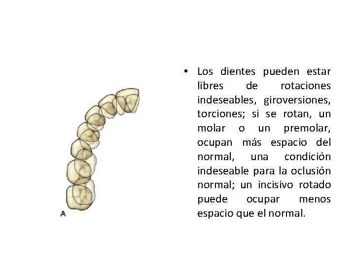  • Los dientes pueden estar libres de rotaciones indeseables, giroversiones, torciones; si se